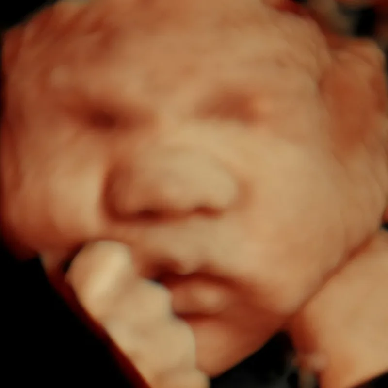 4D vs 5D ultrasound