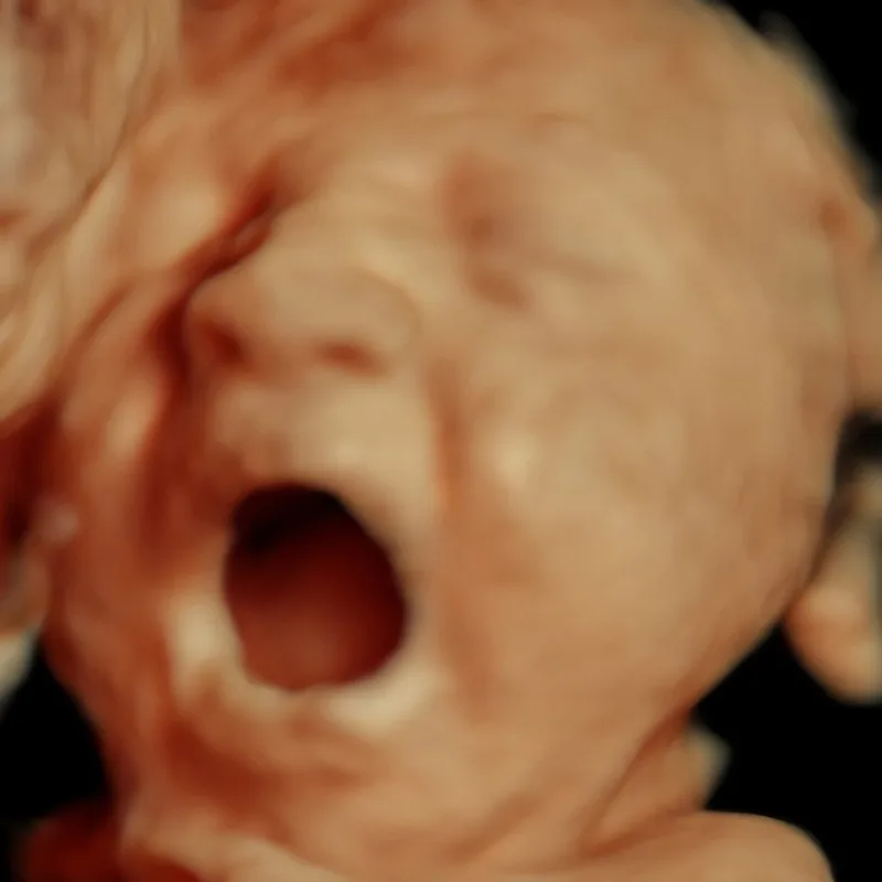 3D ultrasound vs 5D ultrasounds