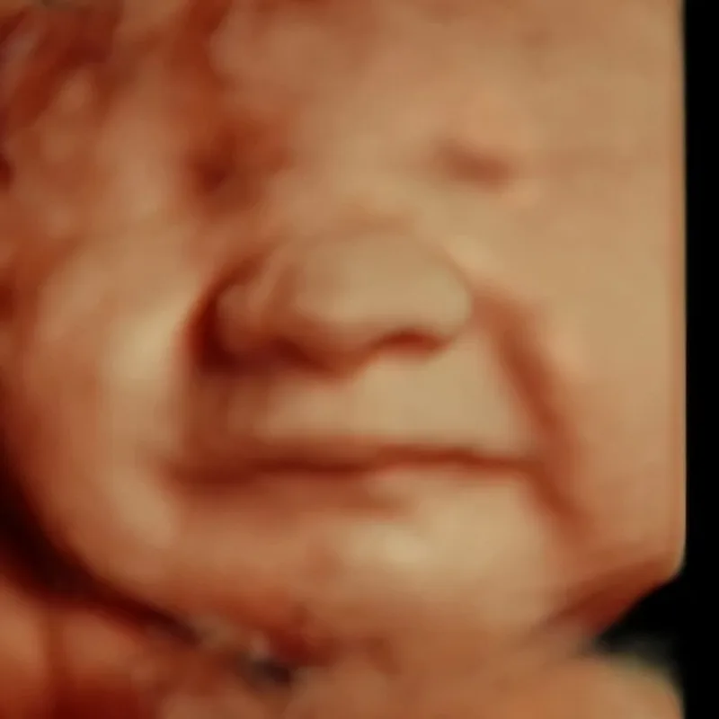 ultrasound of baby in 3D