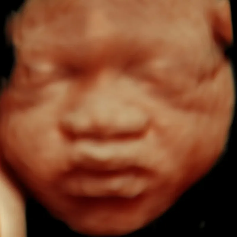 5D hd live scan