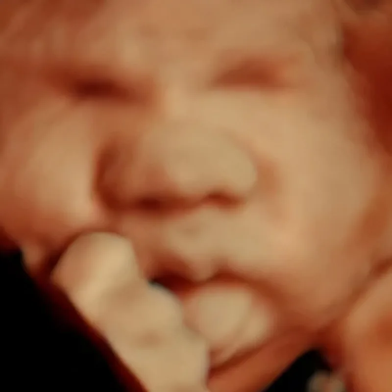 5D 3D ultrasounds