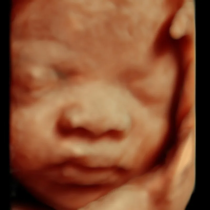 3D ultrasound places