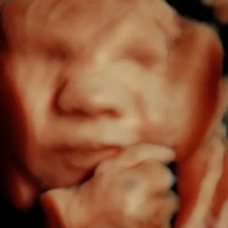 4D 5D ultrasound