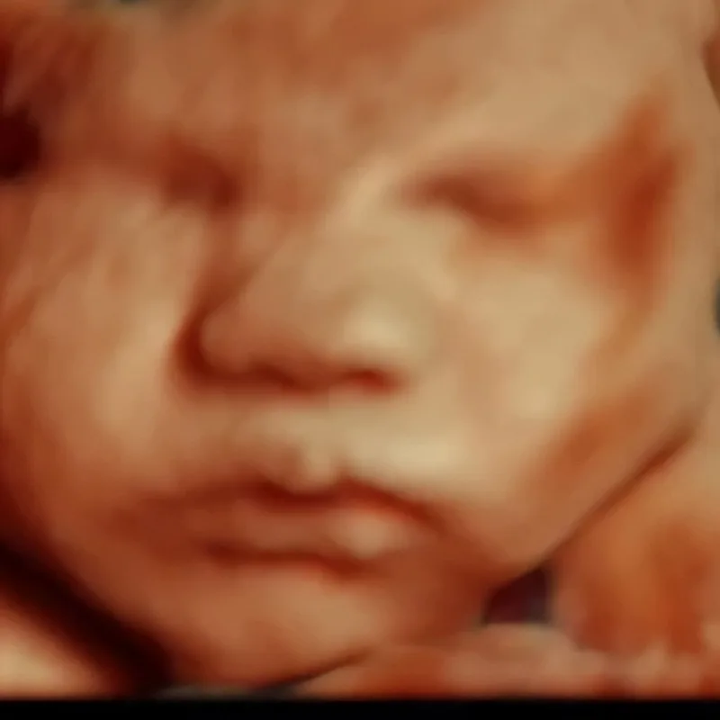 5D HDlive pregnancy ultrasounds