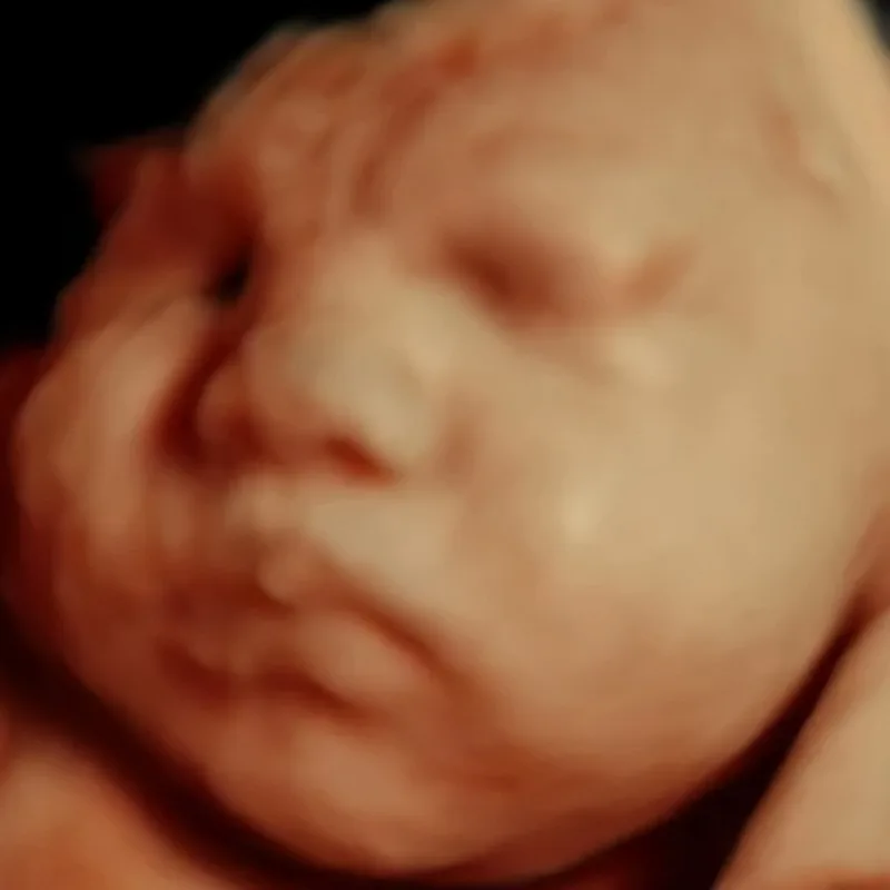 5D HD ultrasound