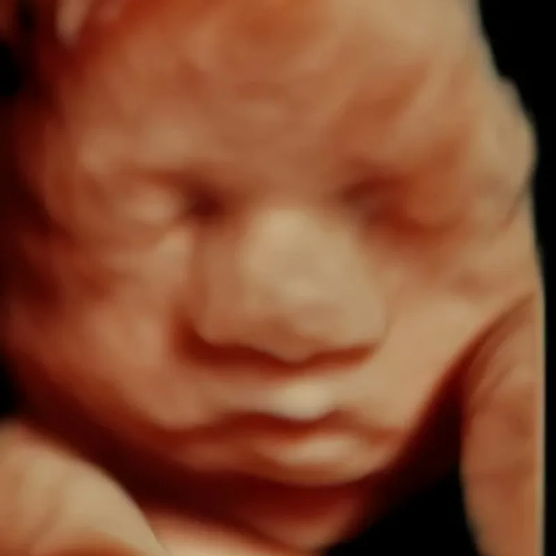 Private 3D ultrasound