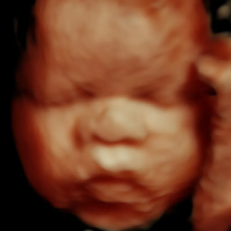 3D/4D 5D ultrasound