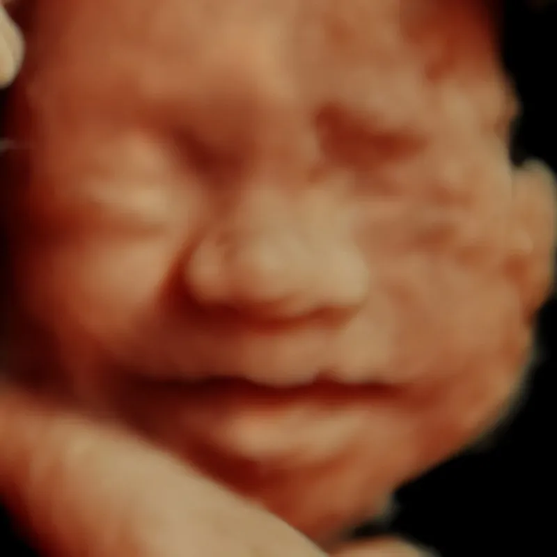 3D ultrasound of baby in 5D