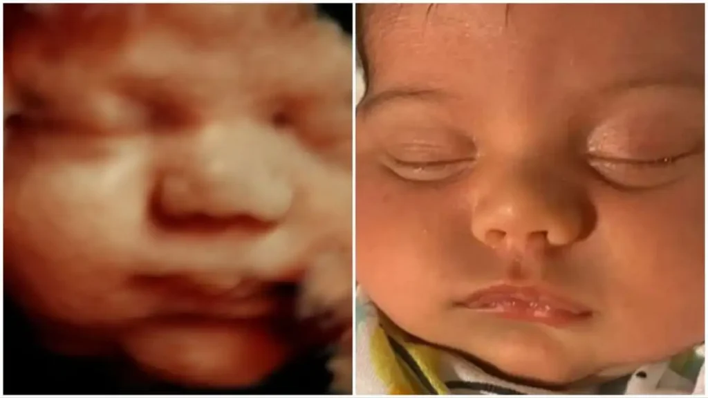 5D ultrasound photo compared to real baby