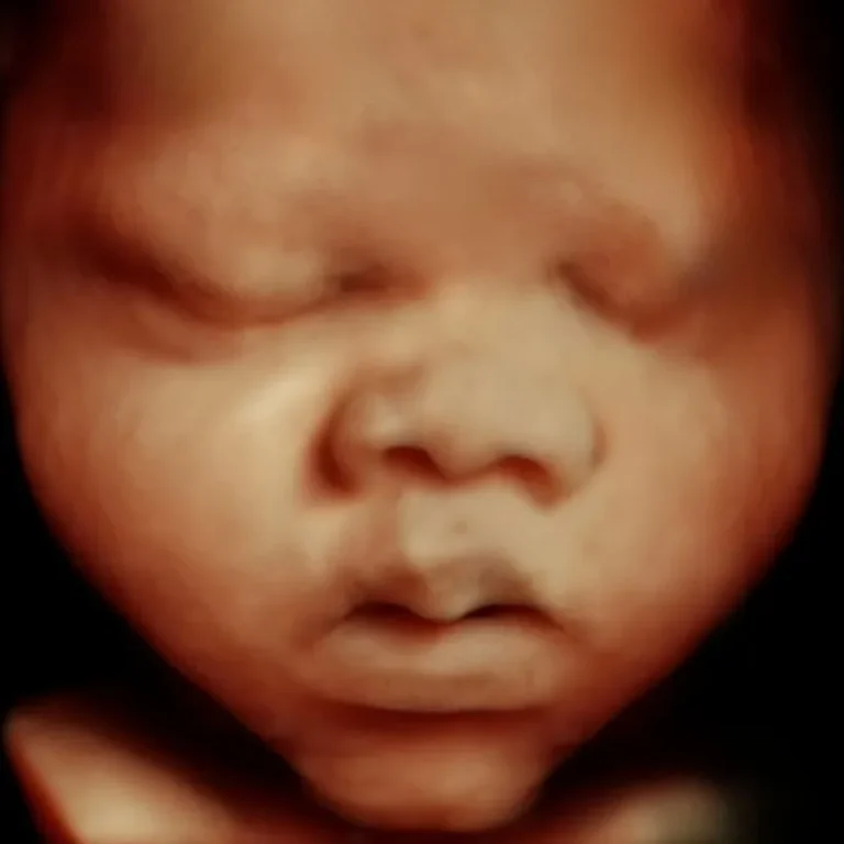 5D scan clear detailed baby face