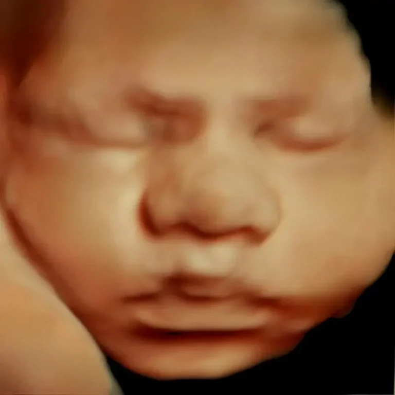 5D HD ultrasound of baby's face