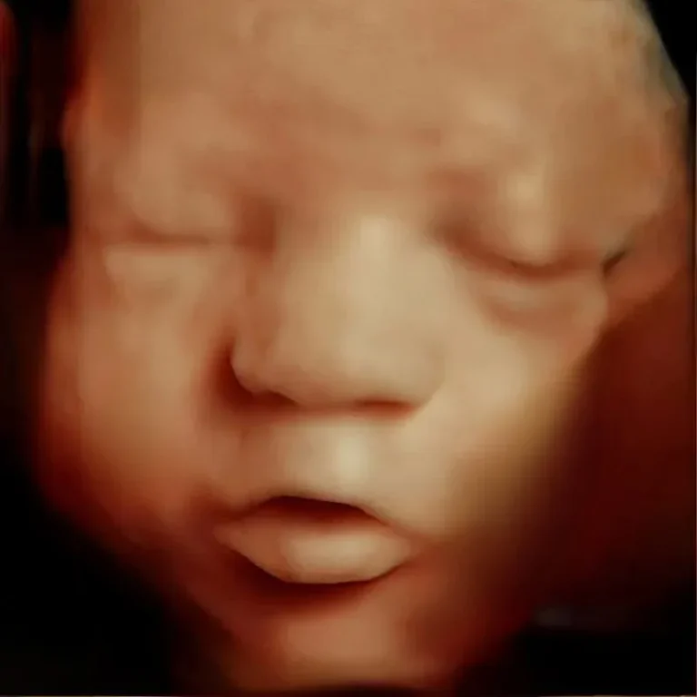 5D baby ultrasound in Michigan during pregnancy