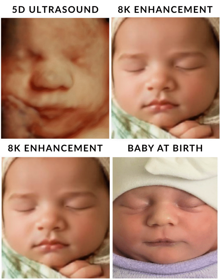 8K Ultrasound Image Enhancement