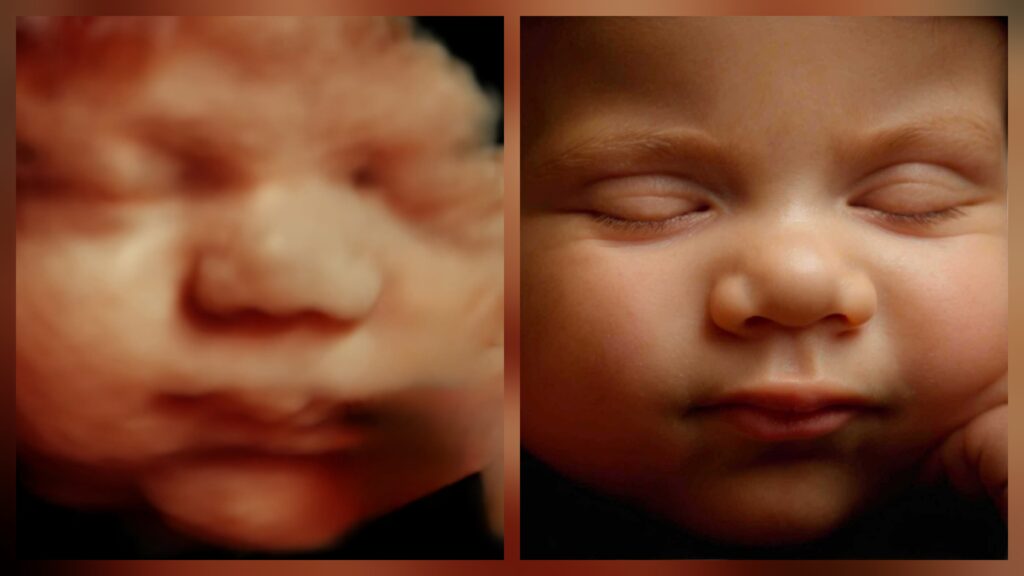 5D Ultrasound vs 8K Ultrasound