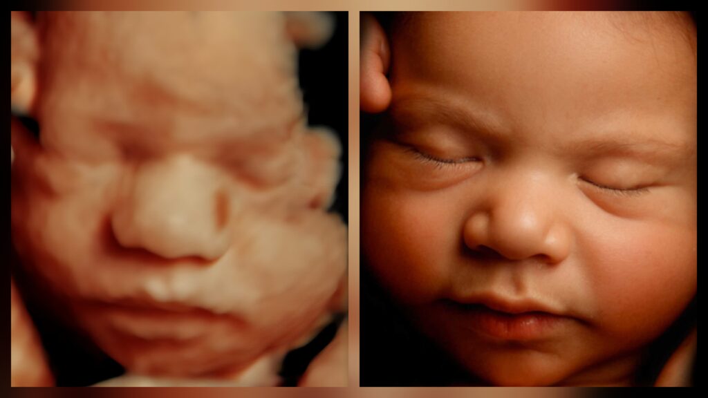 5D Ultrasound vs 8K Ultrasound